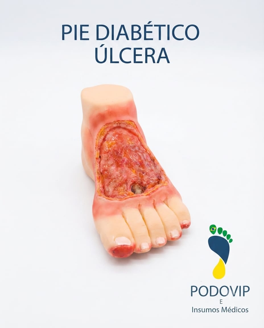 maqueta pie diabetico ulcera