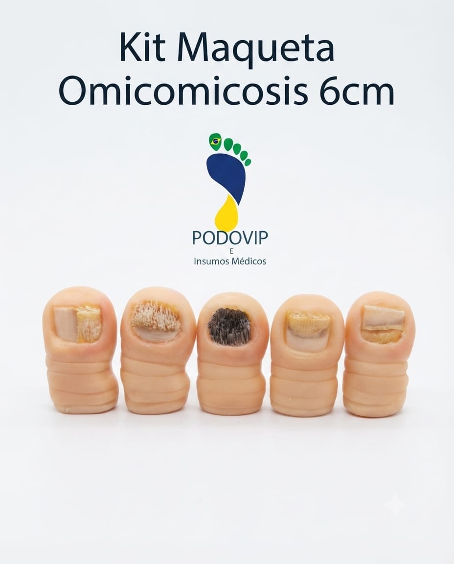 kit maqueta onicomicosis 6 cm
