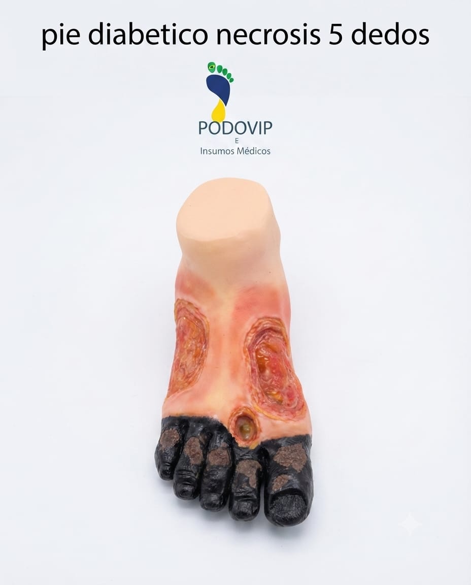 maqueta pie diabetico necrosis 5 dedos ulcera
