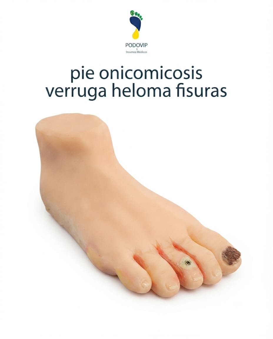 maqueta pie onicomicosis verruga helomas fisuras