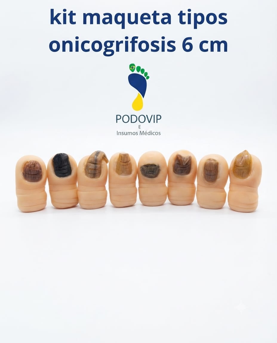 kit maquetas tipo onicogrifosis 6 cm