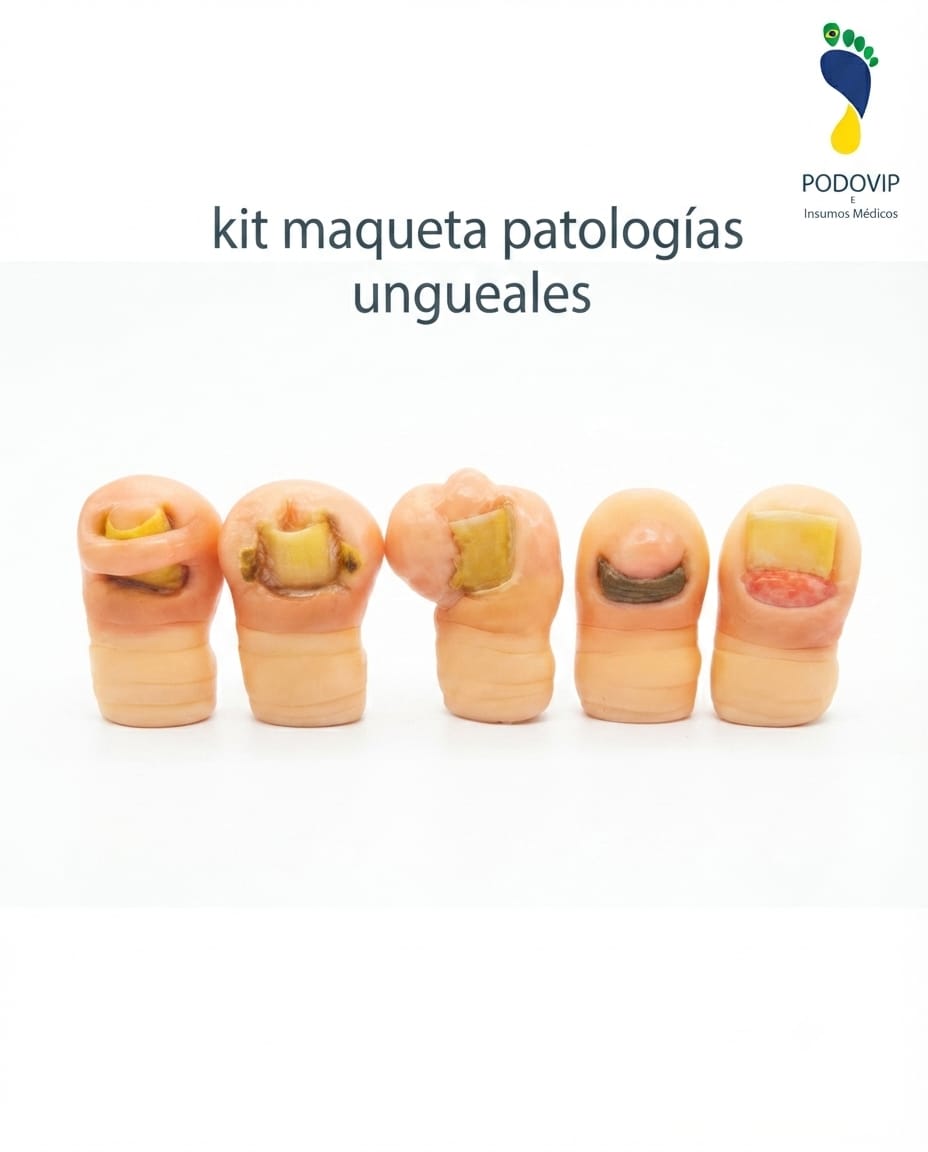 kit maqueta patologias ungueales 6cm c/u
