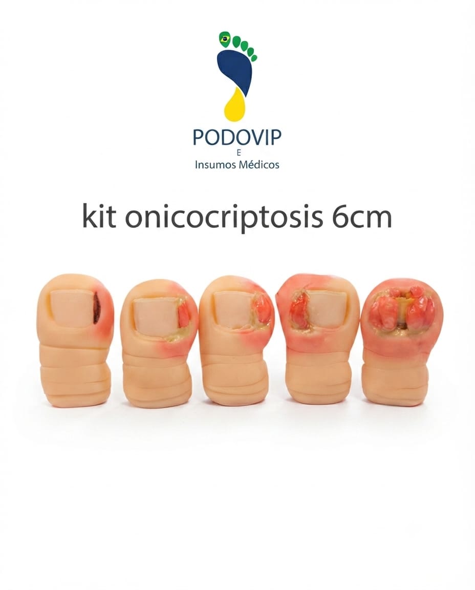 kit maqueta onicocriptosis 6 cm
