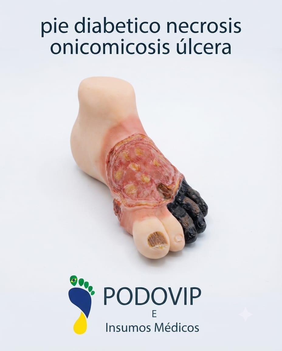 maqueta pie diabetico necrosis onicomicosis ulcera