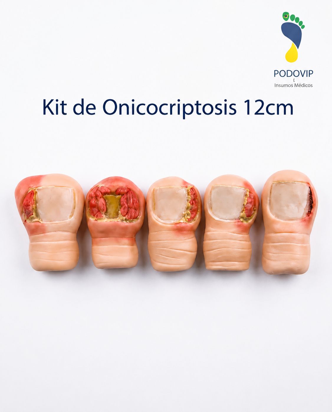 kit de onicocriptosis formato gigante 12 cm